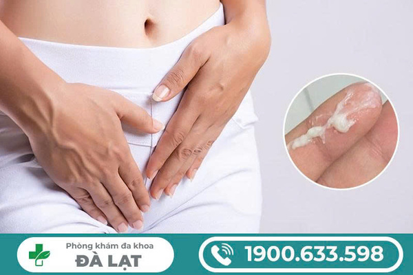 Hình ảnh minh họa