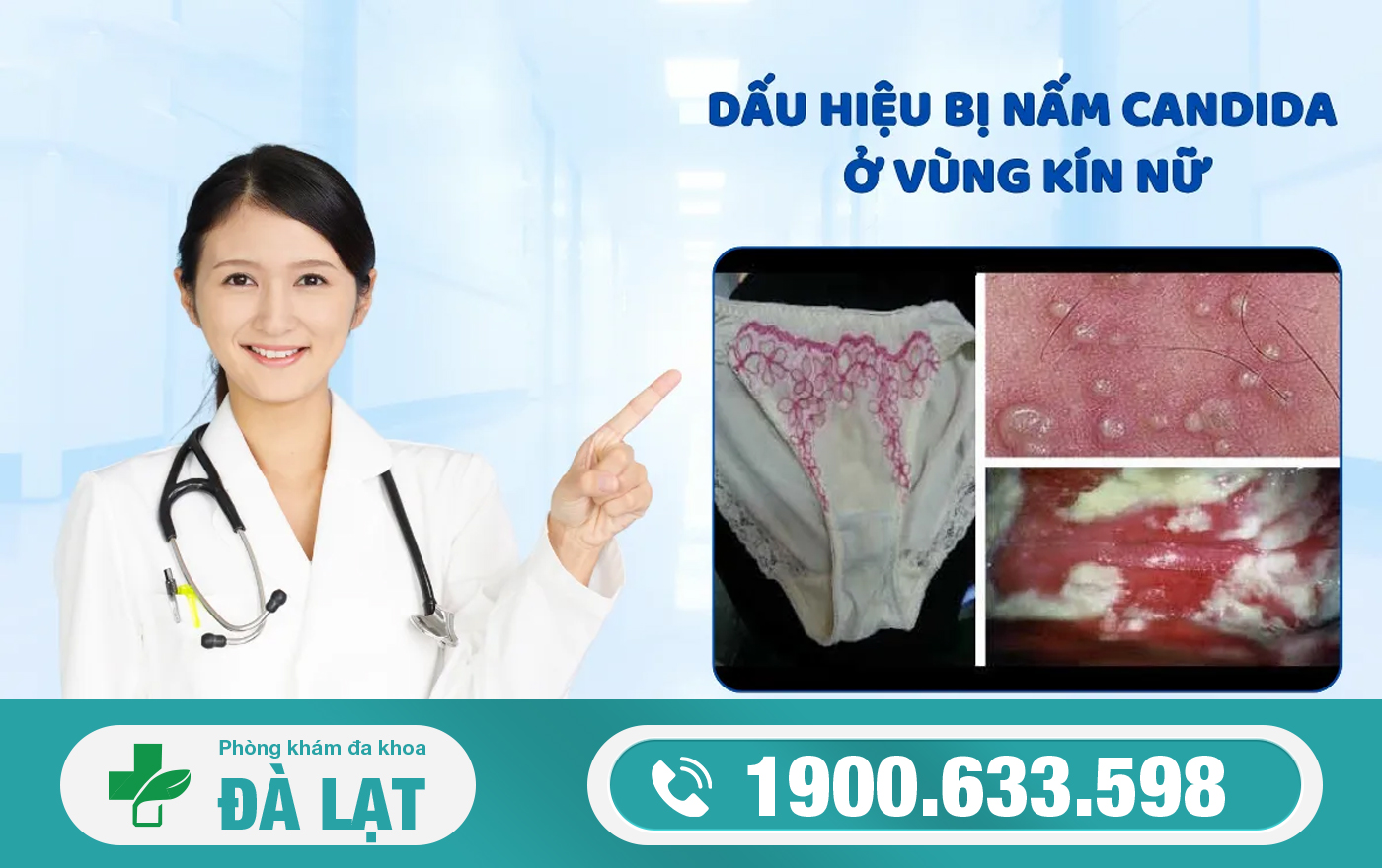 Hình ảnh minh họa