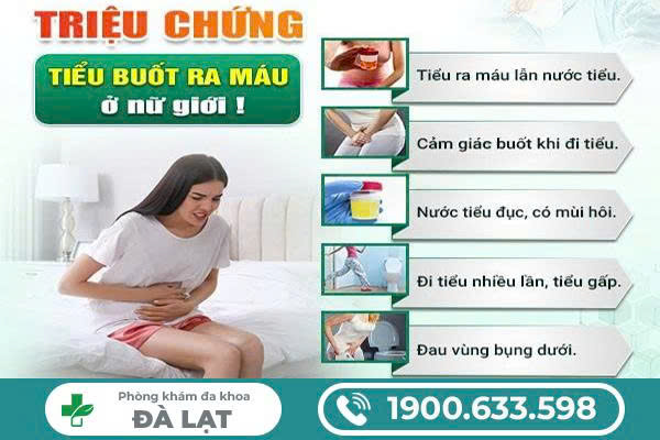 Hình ảnh minh họa