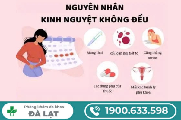 Hình ảnh minh họa