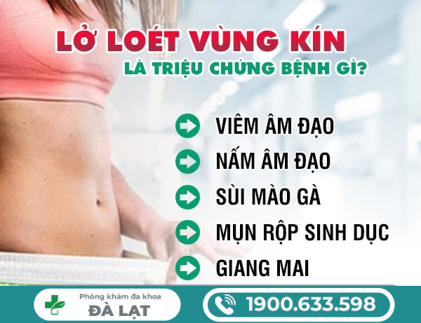 Hình ảnh minh họa