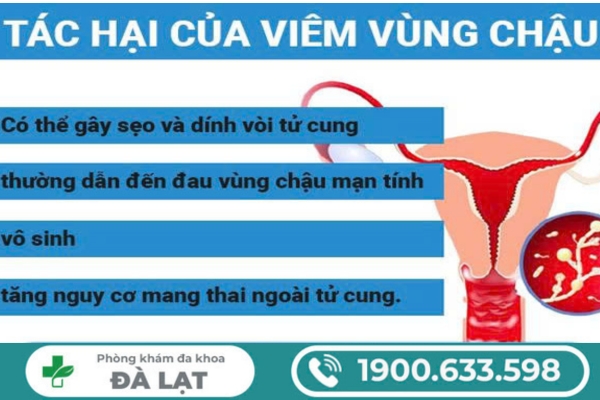 Hình ảnh minh họa