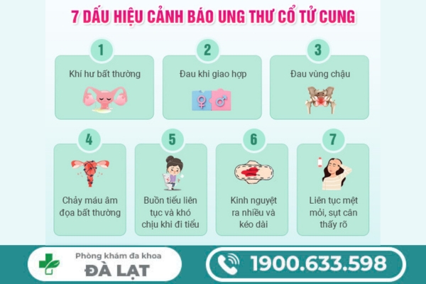 Hình ảnh minh họa