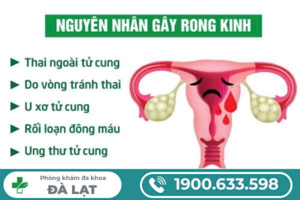 Hình ảnh minh họa
