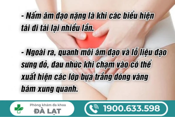 Hình ảnh minh họa