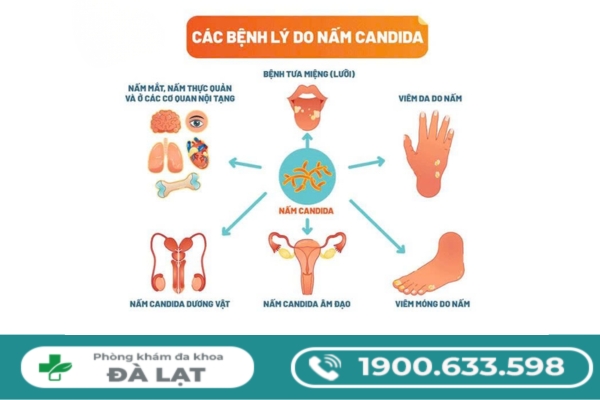 Hình ảnh minh họa