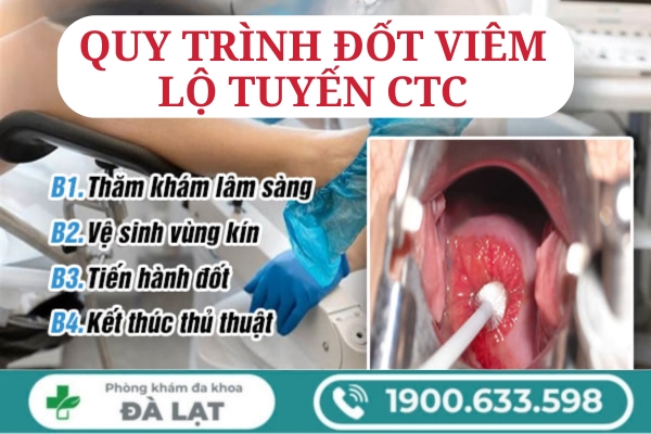 Hình ảnh minh họa