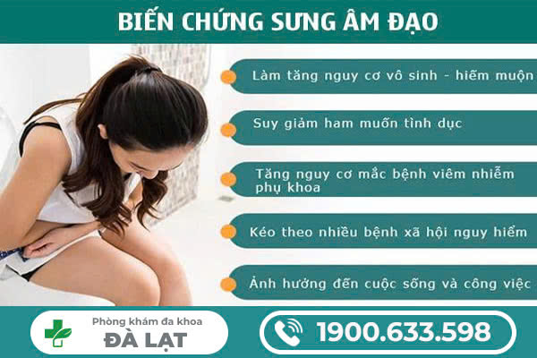 Hình ảnh minh họa