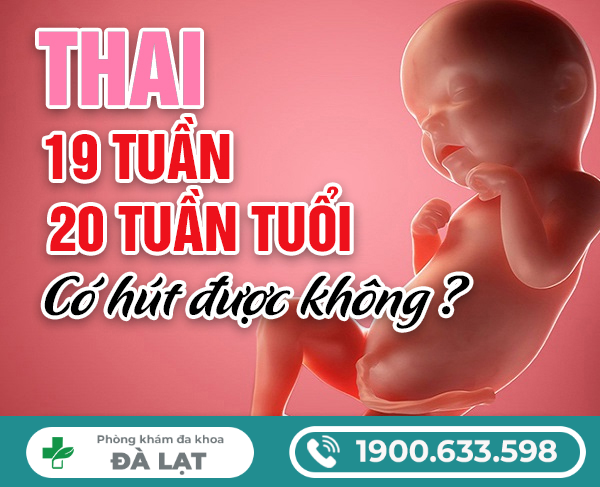 Hình ảnh minh họa