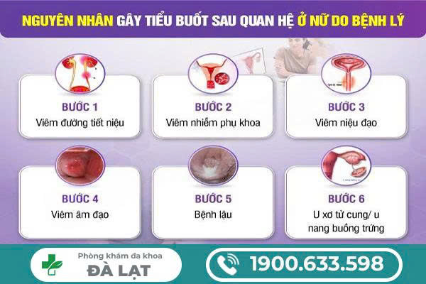 Hình ảnh minh họa