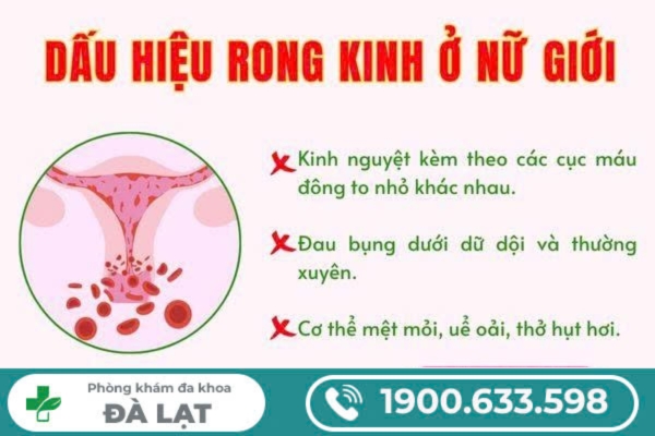 Hình ảnh minh họa