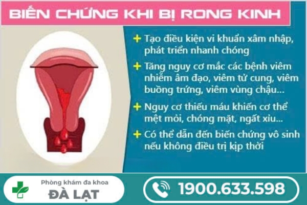 Hình ảnh minh họa